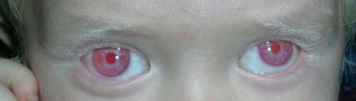 Ojos rojos