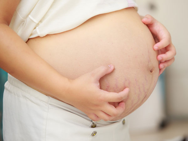 Mujer embarazada rascándose la barriga