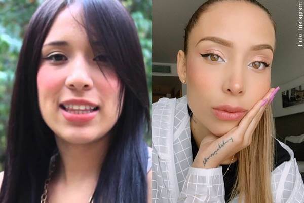 Fotos de Luisa Fernanda W, una de las chicas con Cirugías de famosas colombianas antes y después