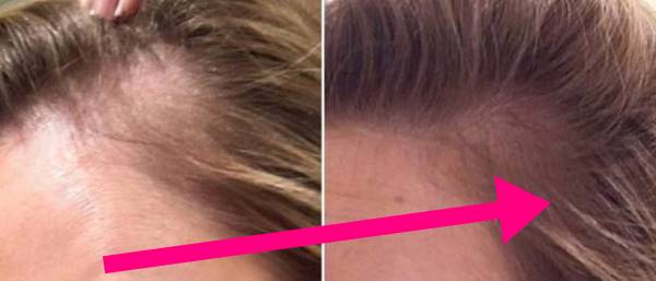Foto de mujer antes y después pelo